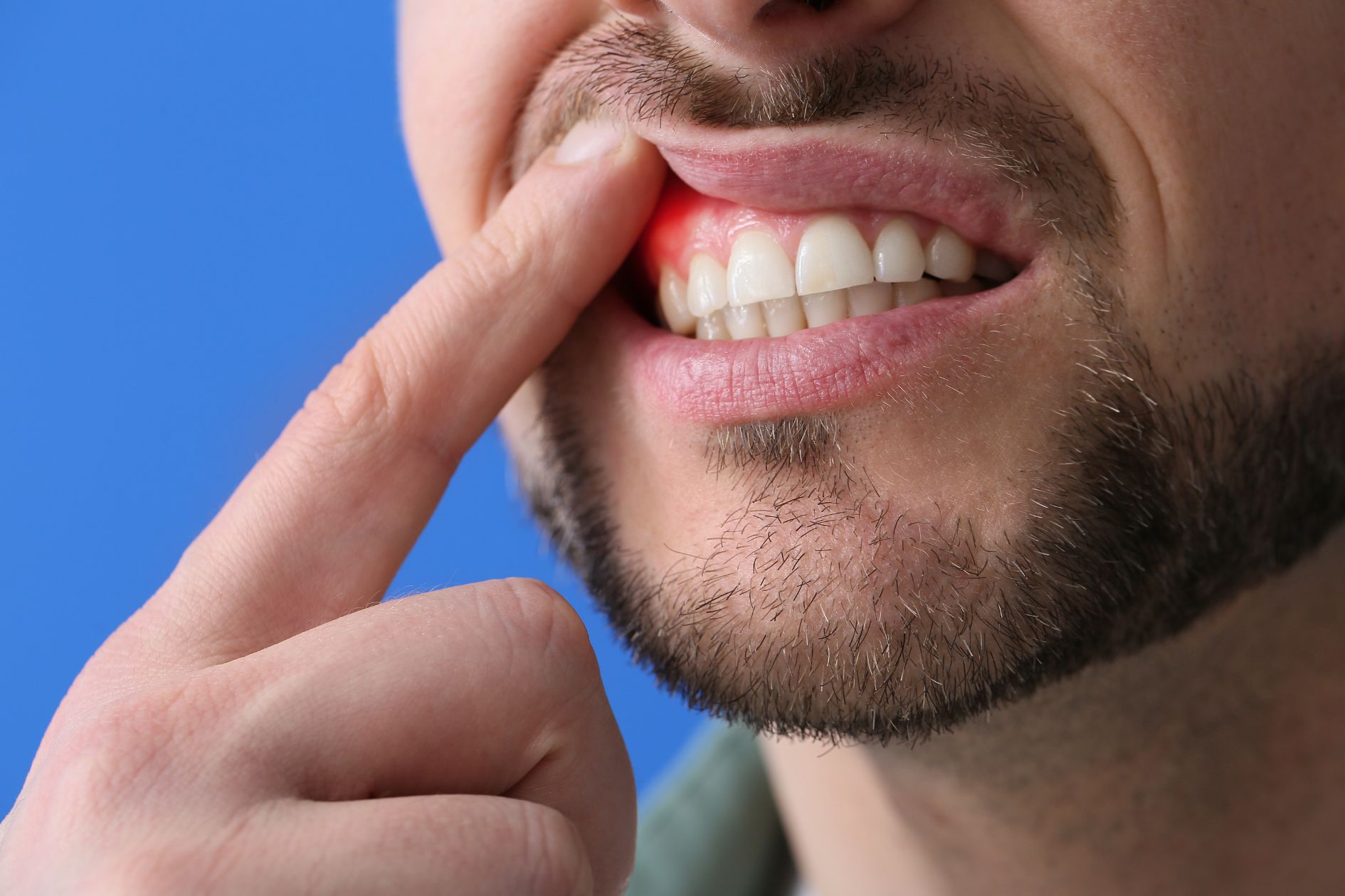 Find The Best Toothpaste For Receding Gums Treatment